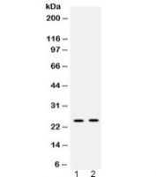 Western blot testing of 1) rat liver and 2) human placenta lysate with HMGB2 antibody at 0.5ug/ml. Expected molecular weight ~24 kDa.
