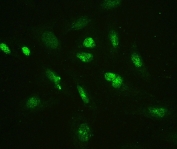IF/ICC staining of FFPE human U-2 OS cells with HMGB2 antibody (green) at 2ug/ml. HIER: steam section in pH6 citrate buffer for 20 min.