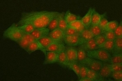 Immunofluorescent staining of FFPE human MCF7 cells with HMGB2 antibody (green) and Alpha Tubulin antibody (red). HIER: steam section in pH6 citrate buffer for 20 min.