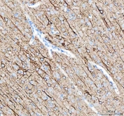 IHC staining of FFPE rat brain tissue with Alpha Internexin antibody. HIER: boil tissue sections in pH8 EDTA for 20 min and allow to cool before testing.