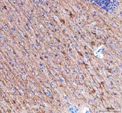 IHC staining of FFPE mouse brain tissue with Alpha Internexin antibody. HIER: boil tissue sections in pH8 EDTA for 20 min and allow to cool before testing.