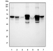 Western blot testing of 1) human SH-SY5Y, 2) human A549, 3) human HeLa, 4) rat brain, 5) rat C6, 6) mouse brain and 7) mouse Neuro-2a cell lysate with Alpha Internexin antibody. Predicted molecular weight ~55 kDa but routinely observed at ~66 kDa.
