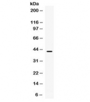 Western blot testing of human SW620 cell lysate with ITLN1 antibody at 0.5ug/ml. Expected molecular weight: 35-40 kDa.