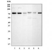 Western blot testing of 1) human MCF7, 2) human A431, 3) human A375, 4) rat heart, 5) mouse heart and 6) mouse NIH 3T3 cell lysate with TAK1 antibody. Predicted molecular weight: 64-69 kDa, routinely observed at 78-82 kDa.