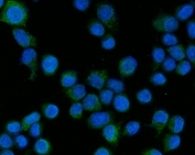 Immunofluorescent staining of FFPE human SiHa cells with TAK1 antibody (green) and DAPI nuclear stain (blue). HIER: steam section in pH6 citrate buffer for 20 min.