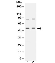 Western blot testing of 1) rat brain and 2) human HeLa lysate with MAP3K8 antibody at 0.5ug/ml. Expected molecular weight: ~58/52 kDa (isoforms 1/2), observed here at ~52 kDa.~