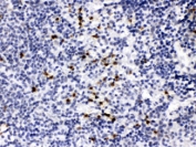 IHC testing of FFPE mouse spleen tissue with MMP-9 antibody at 1ug/ml. HIER: steam in pH6 citrate buffer and allow to cool prior to staining.