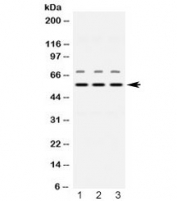 Western blot testing of 1) rat brain, 2) mouse heart and 3) human placenta lysate with Visfatin antibody at 0.5ug/ml. Expected molecular weight ~56 kDa.