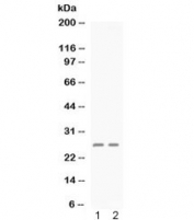Western blot testing of human 1) HEK293 and 2) A549 cell lysate with Platelet factor 4 antibody at 0.5ug/ml. Expected molecular weight: ~8/16/32 kDa (monomer/dimer/tetramer).