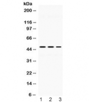 Western blot testing of 1) rat liver, 2) mouse kidney and 3) human HeLa lysate with Perilipin 3 antibody at 0.5ug/ml. Predicted molecular weight ~47 kDa.