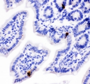 IHC testing of FFPE mouse intestine with PYY antibody. HIER: boil tissue sections in pH6, 10mM citrate buffer, for 10-20 min followed by cooling at RT for 20 min.