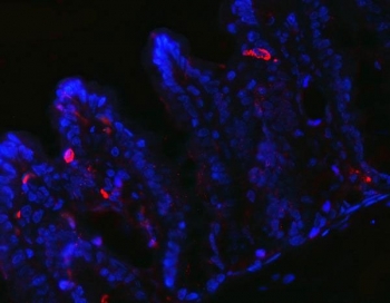 Immunofluorescent staining of FFPE rat stomach tissue with PYY antibody (red) and DAPI nuclear stain (blue). HIER: steam section in pH6 citrate buffer for 20 min.