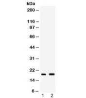 Western blot testing of 1) mouse spleen and 2) mouse liver lysate with PYY antibody at 0.5ug/ml. Expected molecular weight: 11/4 kDa (preproprotein/mature).
