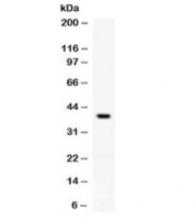 Western blot testing of rat brain lysate with RANKL antibody at 0.5ug/ml. Expected molecular weight: 35-40 kDa.