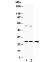 Western blot testing of 1) rat liver and 2) HeLa lysate with VAMP7 antibody at 0.5ug/ml. Expected molecular weight ~25 kDa.