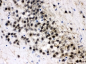 IHC testing of FFPE rat brain with ZWINT antibody at 1ug/ml. HIER: steam in pH6 citrate buffer and allow to cool prior to staining.