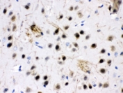 IHC testing of FFPE mouse brain with ZWINT antibody at 1ug/ml. HIER: steam in pH6 citrate buffer and allow to cool prior to staining.