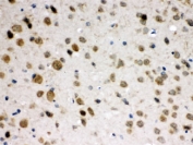 IHC testing of FFPE mouse brain with ABR antibody at 1ug/ml. HIER: steam in pH6 citrate buffer and allow to cool prior to staining.