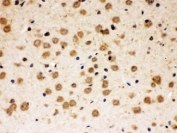 IHC testing of FFPE rat brain with ABR antibody at 1ug/ml. HIER: steam in pH6 citrate buffer and allow to cool prior to staining.