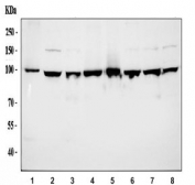Western blot testing of human 1) MCF7, 2) HeLa, 3) HepG2, 4) HT1080, 5) placenta, 6) A549, 7) U-251 MG and 8) RT-4 cell lysate with ACTN4 antibody at 0.5ug/ml. Predicted molecular weight ~105 kDa.