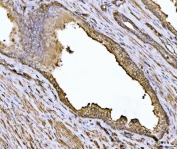 IHC testing of FFPE rat kidney with ACTN4 antibody at 1ug/ml. HIER: steam in pH6 citrate buffer and allow to cool prior to staining.