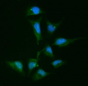 Immunofluorescent staining of FFPE human HeLa cells with ACTN4 antibody (green) and DAPI nuclear stain (blue). HIER: steam section in pH6 citrate buffer for 20 min.