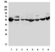 Western blot testing of 1) human K562, 2) human HepG2, 3) rat lung, 4) rat heart, 5) rat kidney, 6) mouse lung, 7) mouse kidney and 8) mouse ovary with ALDH1A2 antibody. Predicted molecular weight ~56 kDa.