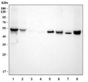 Western blot testing of 1) human K562, 2) human 293T, 3) human HepG2, 4) human HeLa, 5) rat kidney, 6) rat testis, 7) mouse kidney and 8) mouse testis with ALDH1A2 antibody. Predicted molecular weight ~56 kDa.
