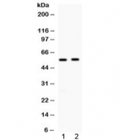 Western blot testing of 1) rat liver and 2) human 22RV1 lysate with ALDH3A2 antibody at 0.5ug/ml. Predicted molecular weight: ~54kDa.
