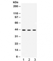 Western blot testing of 1) rat kidney, 2) rat liver and 3) human HepG2 lysate with AMACR antibody at 0.5ug/ml. Predicted molecular weight ~43 kDa.