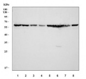 Western blot testing of human 1) 293T, 2) MCF7, 3) HL60, 4) Caco-2, 5) K562, 6) HepG2, 7) PC-3 and 8) A549 cell lysate with AMHR2 antibody at 0.5ug/ml. Predicted molecular weight: ~63 kDa.