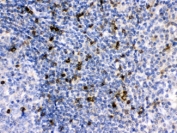 IHC testing of FFPE human tonsil with APOBEC3G antibody at 1ug/ml. HIER: steam in pH6 citrate buffer and allow to cool prior to staining.