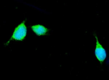 Immunofluorescent staining of FFPE mouse HEPA1-6 cells with Apolipoprotein E antibody (green) and DAPI nuclear stain (blue). HIER: steam section in pH6 citrate buffer for 20 min.