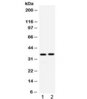 Western blot testing of 1) mouse spleen and 2) mouse kidney lysate with APOE antibody at 0.5ug/ml. Predicted molecular weight: 34-37 kDa.