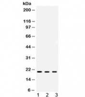 Western blot testing of 1) rat kidney, 2) mouse kidney and 3) human MCF7 lysate with ARF6 antibody at 0.5ug/ml. Predicted molecular weight ~20 kDa.