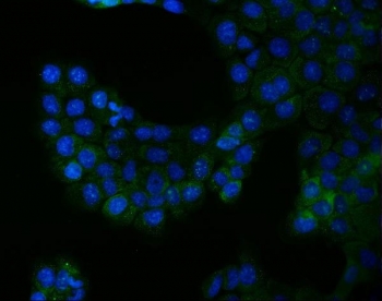 Immunofluorescent staining of FFPE human A431 cells with BCR antibody (green) and DAPI nuclear stain (blue). HIER: steam section in pH6 citrate buffer for 20 min.