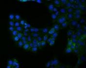 Immunofluorescent staining of FFPE human A431 cells with BCR antibody (green) and DAPI nuclear stain (blue). HIER: steam section in pH6 citrate buffer for 20 min.