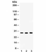 Western blot testing of 1) rat ovary, 2) mouse liver and 3) human MCF7 lysate with CA2 antibody at 0.5ug/m. Predicted/observed molecular weight ~29 kDa.