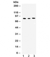 Western blot testing of 1) rat kidney, 2) mouse spleen and 3) human Jurkat lysate with Cyclin T1 antibody at 0.5ug/ml. Predicted/observed molecular weight ~81 kDa.