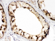 IHC testing of FFPE human testis tissue with TCP1 beta antibody at 1ug/ml. HIER: steam in pH6 citrate buffer and allow to cool prior to staining.