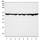 Western blot testing of human 1) A549, 2) RT4, 3) Caco-2, 4) 293T, 5) MCF7, 6) HEL, 7) Raji and 8) SW620 cell lysate with TCP1 beta antibody. Predicted molecular weight ~57 kDa. 