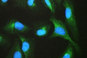 Immunofluorescent staining of FFPE human U-2 OS cells with TCP1 beta antibody (green) at 2ug/ml and DAPI nuclear stain (blue). HIER: steam section in pH6 citrate buffer for 20 min.