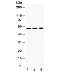 Western blot testing of 1) rat brain, 2) mouse brain and 3) human U20S lysate with TCP1 theta antibody. Expected/observed molecular weight ~60 kDa.
