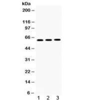Western blot testing of 1) rat brain, 2) mouse brain and 3) human U-2 0S lysate with TCP1 theta antibody. Expected/observed molecular weight ~60 kDa.