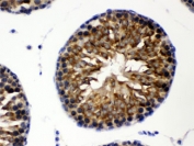 IHC testing of FFPE rat testis with TCP1 theta antibody at 1ug/ml. HIER: steam in pH6 citrate buffer and allow to cool prior to staining.