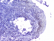 IHC staining of FFPE human tonsil tissue with Cdk6 antibody at 1ug/ml. HIER: boil tissue sections in pH6, 10mM citrate buffer, for 10-20 min followed by cooling at RT for 20 min.