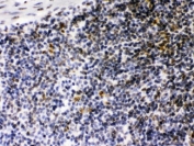IHC testing of FFPE mouse spleen with CIITA antibody at 1ug/ml. HIER: steam in pH6 citrate buffer and allow to cool prior to staining.