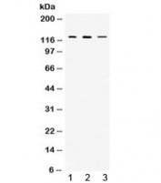 Western blot testing of 1) rat thymus, 2) mouse thymus and 3) MCF7 lysate with CIITA antibody at 0.5ug/ml. Predicted/observed molecular weight ~123 kDa.