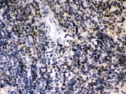IHC testing of FFPE rat spleen with CIITA antibody at 1ug/ml. HIER: steam in pH6 citrate buffer and allow to cool prior to staining.