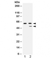 Western blot testing of 1) human placenta and 2) HepG2 lysate with Carboxypeptidase B2 antibody at 0.5ug/ml. Predicted molecular weight: ~48 kDa but routinely observed at 50-60 kDa.